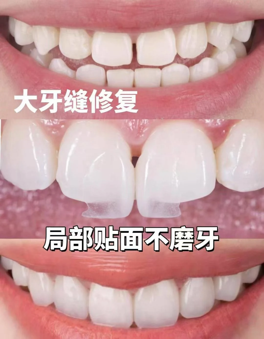 雅齐口腔提供的牙齿对比图片 4